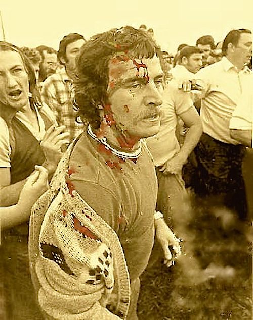 meatworker-bashed-by-snr-cnst-john-watt-in-secondary-boycott-of-live-cattle-1978-at-hamilton-wharf-brisbane